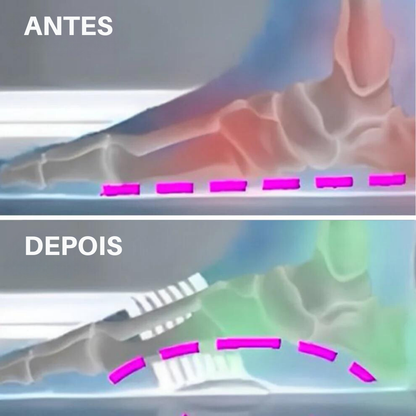 Arch Support Band - Pedivit