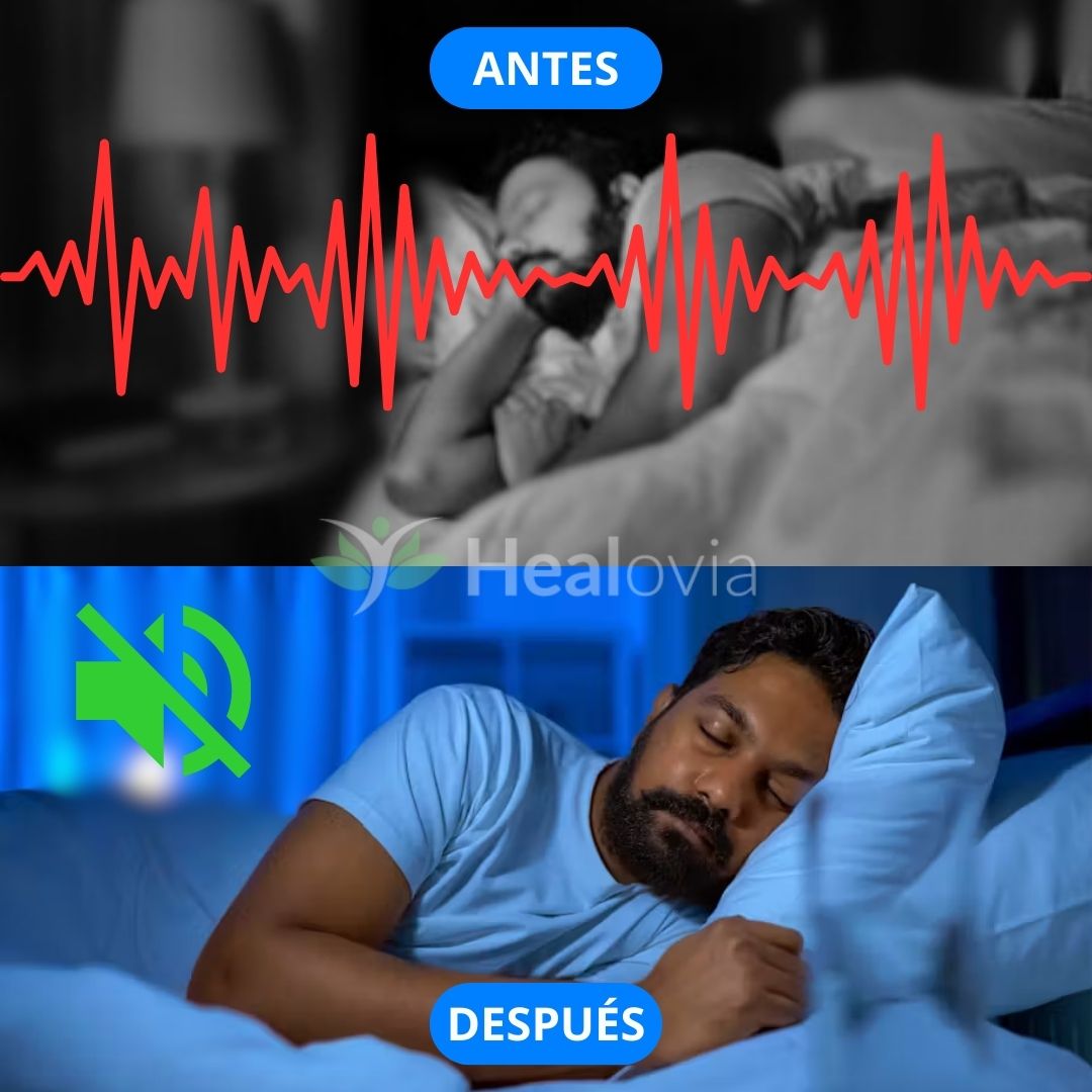 Banda para apnea del sueño Healovia®