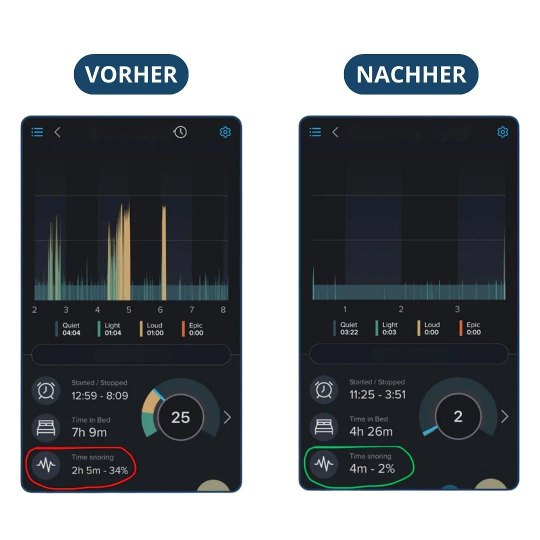 Znorex® Anti-Schnarch-Schiene
