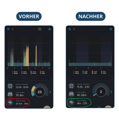 Znorex® Anti-Schnarch-Schiene