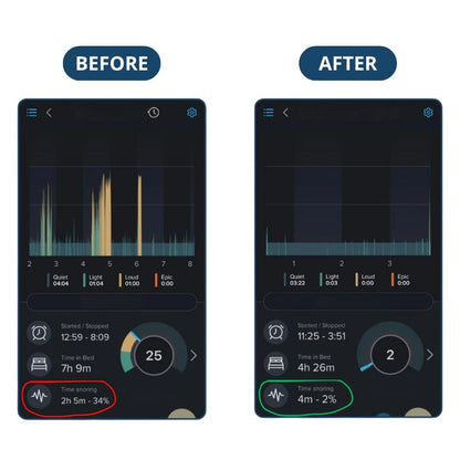 Silentek® Smart Anti-Snoring EMS Device