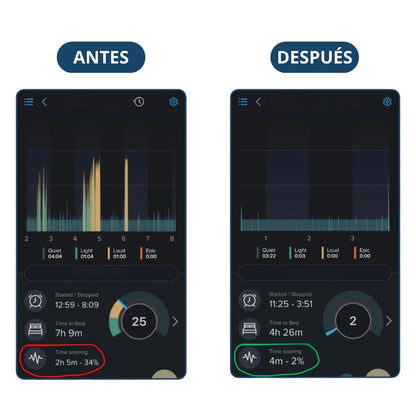 Znorex® Protector Bucal Anti-Ronquidos