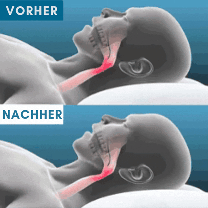 Znorex® Anti-Schnarch-Schiene